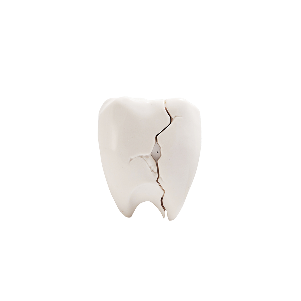 Crack Tooth